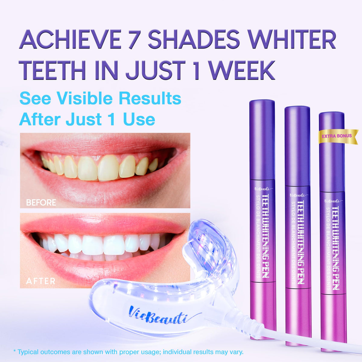 VieBeaut Teeth Whitening Kit – 32X LED Light + Gel Pen for Sensitive Teeth, Removes Stains from Food, Coffee, Wine & Smoking