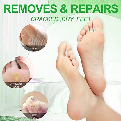 Pedicure Kit Foot Soak Set: Bubble Salt, Sugar Scrub, Massage Mask, Massage Lotion in a Box, 4 Step Foot Spa Kit for Dry Feet,Tired Feet（3 Set Tropical Fruit)