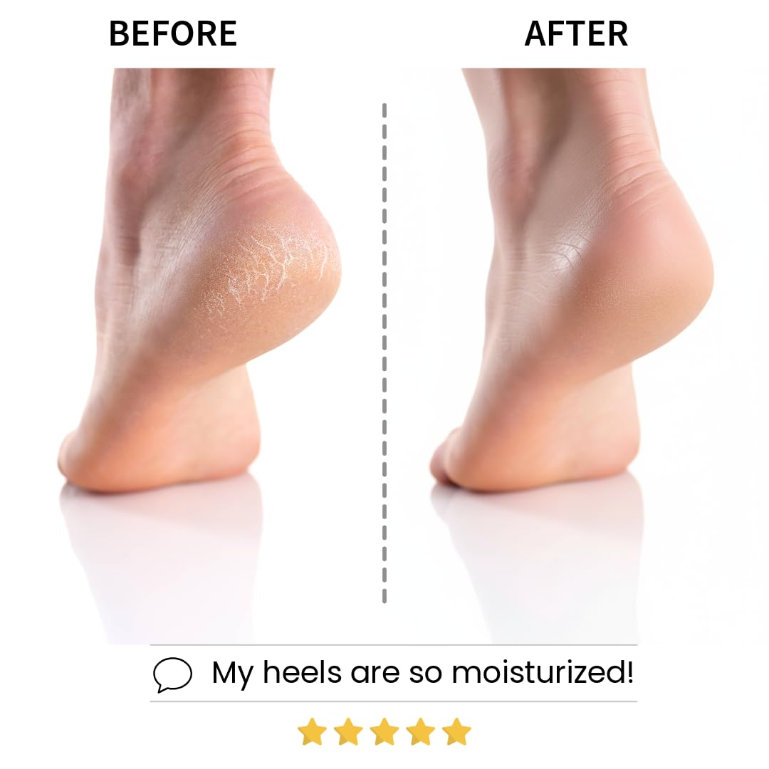 Codi New York Relaxing Aroma Foot Mask, Home Spa Moisturizing Pedicure Socks, 6 Pairs, For Dry Cracked Heel, Hydrating Foot Treatment, Made in Korea (Peppermint)