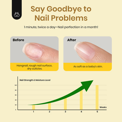 Beetles Nail Prep Kit Nail Dehydrator and Primer Nail Care Tool Kit 20ml Large Capacity Acid-Free & Hema-Free Dehydrate Bond Primer with Manicure Tools for Acrylic Nail Gifts for Women