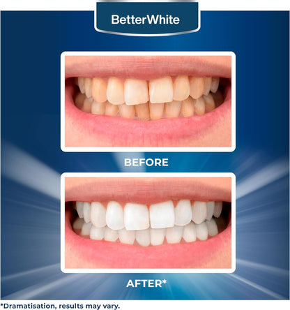 Premium Teeth Whitening Strips 14 Treatments - Enamel Safe - Non-Sensitive Formula - 28 Peroxide-Free Whitening Strips - Dentist Formulated Teeth Whitening Kit + Mouth Opener Included