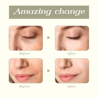 Tekson Faical Roller Massager, 3D Metal Face Massage Tool for Reduce Puffiness, Remove Eye Wrinkles, Face Lift, Increase Firmness, Anti-Aging, Skin Tightening (Zinc Alloy)