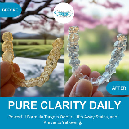 Retainer Cleaner Tablets - 120 Tablets 4 Month Retainer Fresh - Retainer Cleaning Tablets, Mouth Guard Cleaner, Denture Cleaner, Aligner Cleaner, Brite Retainer Tablets