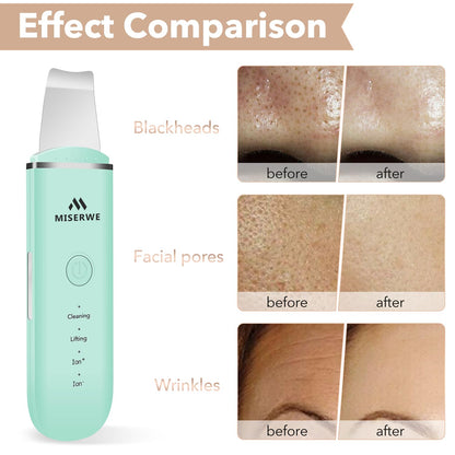 Skin Scrubber Face Skin Spatula Facial Scrubber Spatula for Deep Cleansing Blackhead Remover Pore Cleaner with 4 Modes (White)