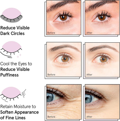 grace & stella Under Eye Patches (12 pairs) Eye Masks for Puffy Eyes and Dark Circles - Graduation Gifts for Teens, Birthdays, Bachelorette Party Favors, Self Care Gifts for Women - Vegan Cruelty-Free