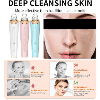 Blackhead Remover Pore Vacuum, Upgraded USB Rechargeable Facial Pore Cleaner Blackhead Removal Kit with 3 Suction Power,5 Probes Black Head Extractions Tool for Women & Men