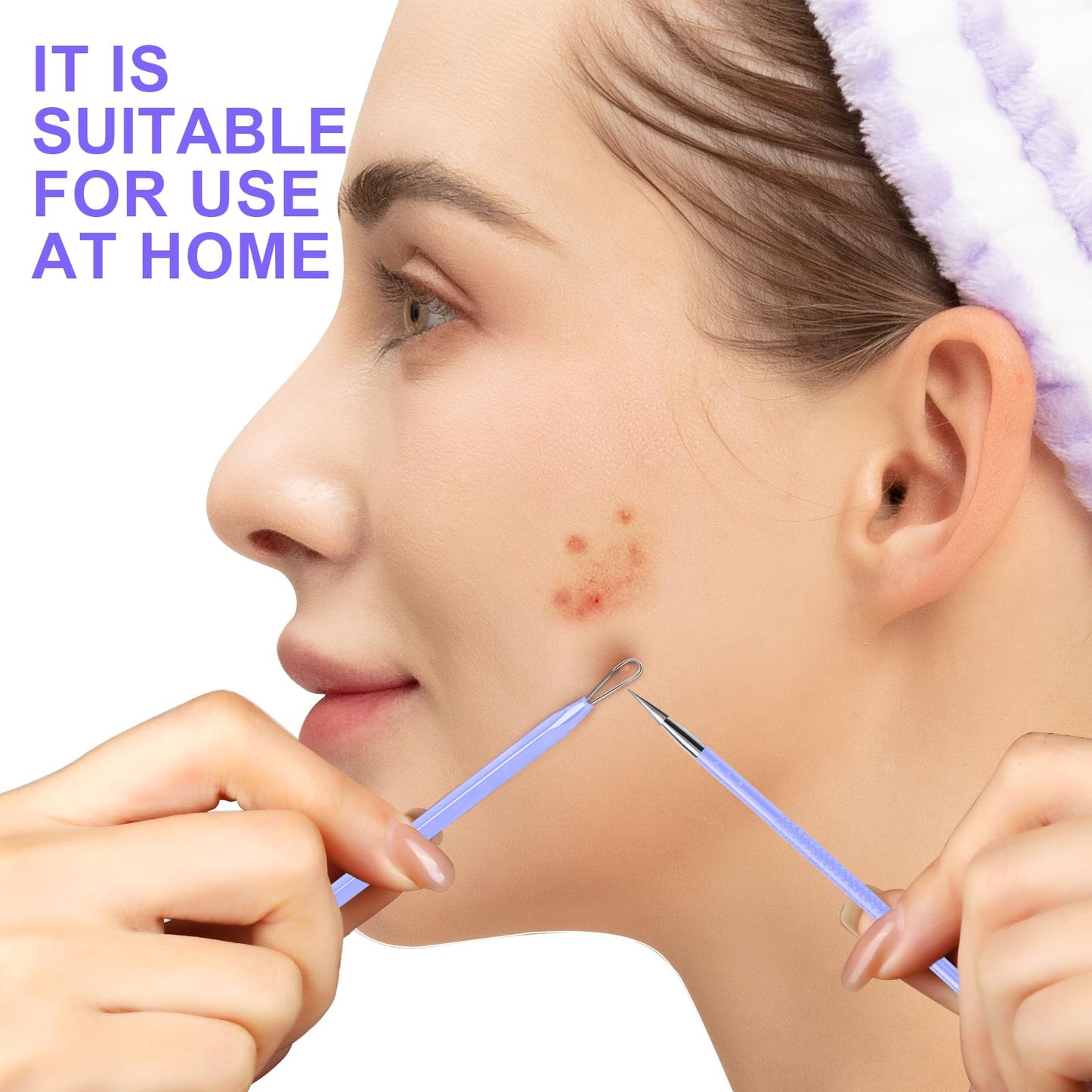 Teenitor Pimple Extractor Acne Treatment Tool Surgical Grade Blackhead Comedone Removal 2-in-1 Popper Tool for Face Nose Blackhead Extractor Tool Silver