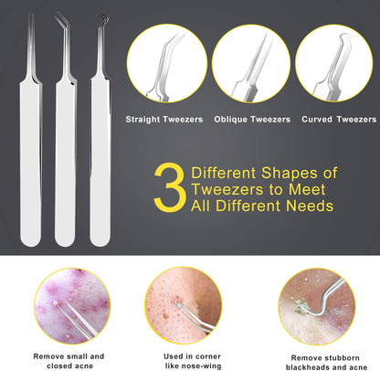Pimple Popper Tool Kit - Boxoyx 10 Pcs Blackhead Remover Comedone Extractor Kit with Metal Case for Quick and Easy Removal of Pimples, Blackheads, Zit Removing, Forehead,Facial and Nose(Silver)