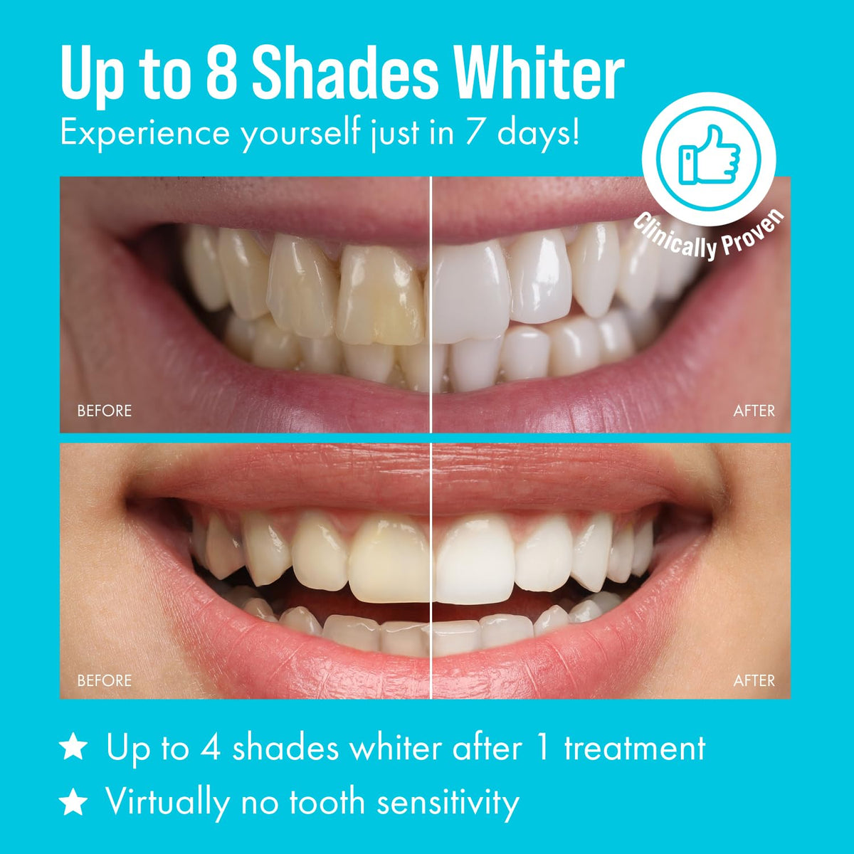 Cali White Teeth Whitening Strip Kit with LED Light and Batteries - Organic Peroxide Teeth Whitening Gel - Set of White Strips - 2x5ml Syringes, Thermoform Whitening Kit Trays and Case