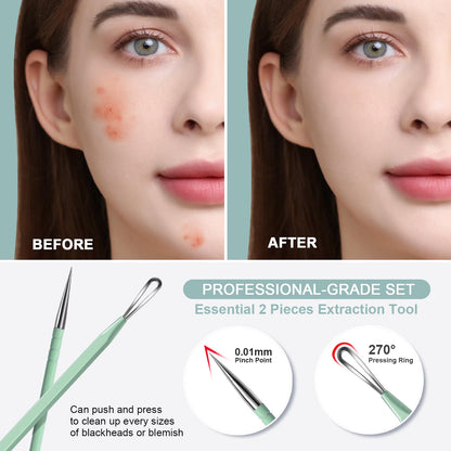 Teenitor Pimple Extractor Acne Treatment Tool Surgical Grade Blackhead Comedone Removal 2-in-1 Popper Tool for Face Nose Blackhead Extractor Tool Silver