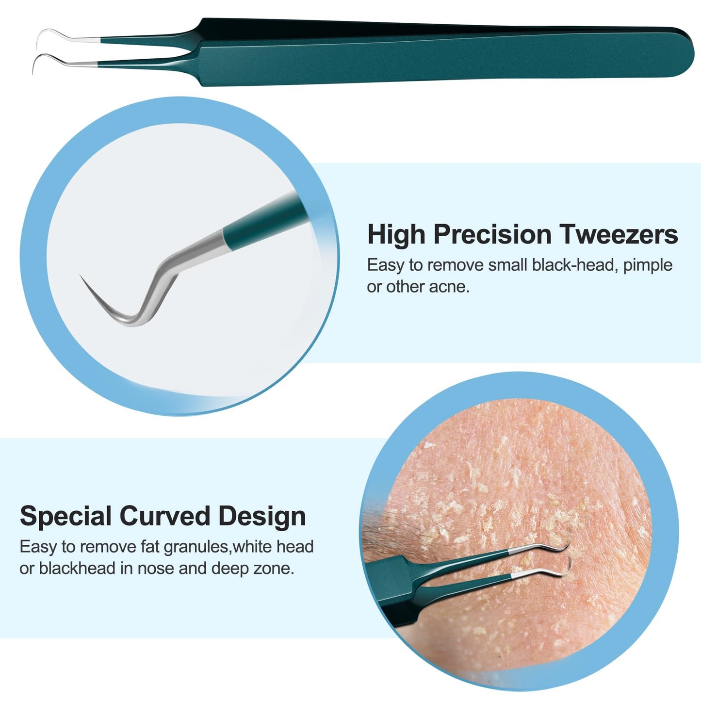 Pimple Popper Tool Kit Blackhead Remover Tools (5 Piece Kit), Professional Stainless Black Head Remover for face, Risk Free Treatment Pimple Extractor with Tweezers