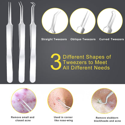 Pimple Popper Tool Kit - Boxoyx 10 Pcs Blackhead Remover Comedone Extractor Kit with Box for Quick and Easy Removal of Pimples, Blackheads, Zit Removing, Forehead,Facial and Nose (Black)