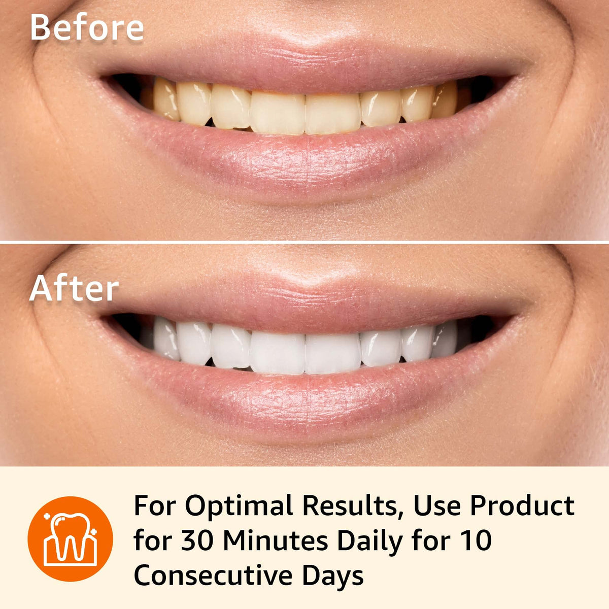 Amazon Basics 10 Day Teeth Whitening Strips Kit, 10 Treatments, 1-Pack (Previously Solimo)