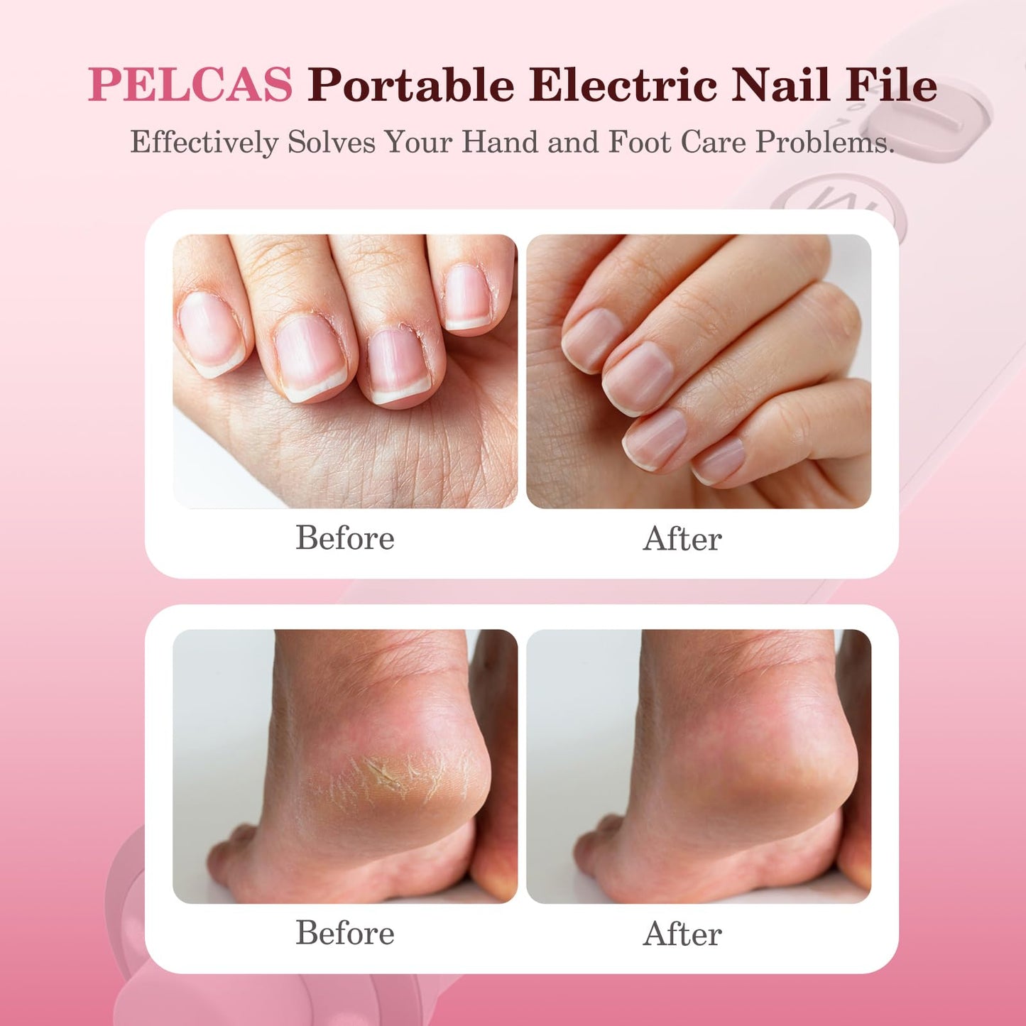 PELCAS Electric Nail Grinder, 10 Speeds Cordless Nail Drill with LED Light, Portable Manicure and Pedicure Kit, Nail File with LCD Screen for Human, Pet, Thick Toenails, Natural & Acrylic Nails Grey