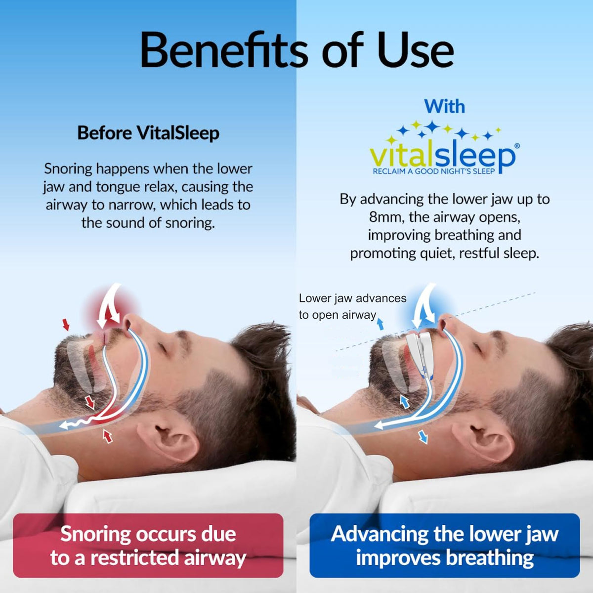 VitalSleep Anti-Snoring Mouthpiece, Comfortable & Adjustable Snore Guard, Quiets Snoring, USA Made, BPA Free & FDA Cleared Anti-Snore Device – Men’s Size
