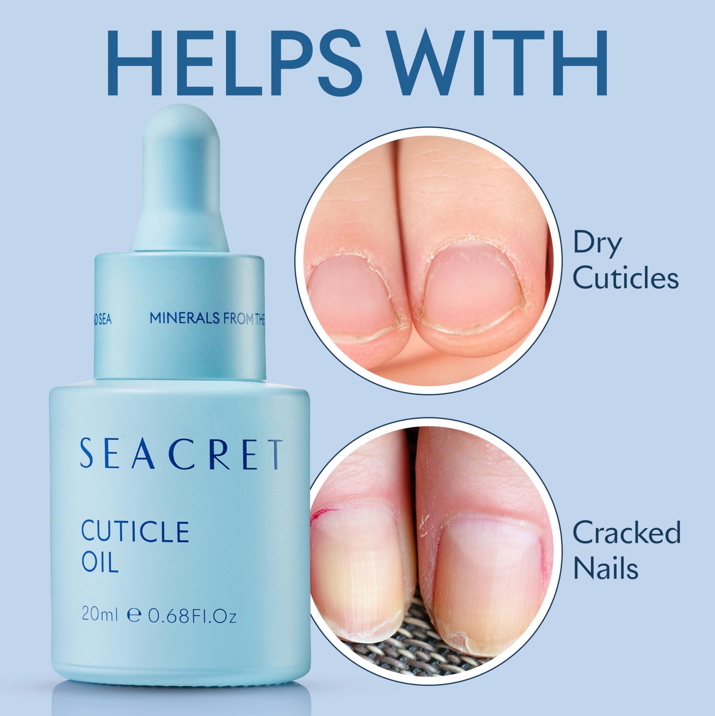 SEACRET NAIL CARE COLLECTION: Dead Sea Mineral Fingernail & Toenail DIY Salon Manicure Treatment Set with File, 3-Way Buffer Block for Shine, 1 Oz Cuticle Oil, & 6.8 Oz Body Lotion Kit