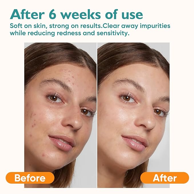 Face Towels, Ultra Soft Facial Towel