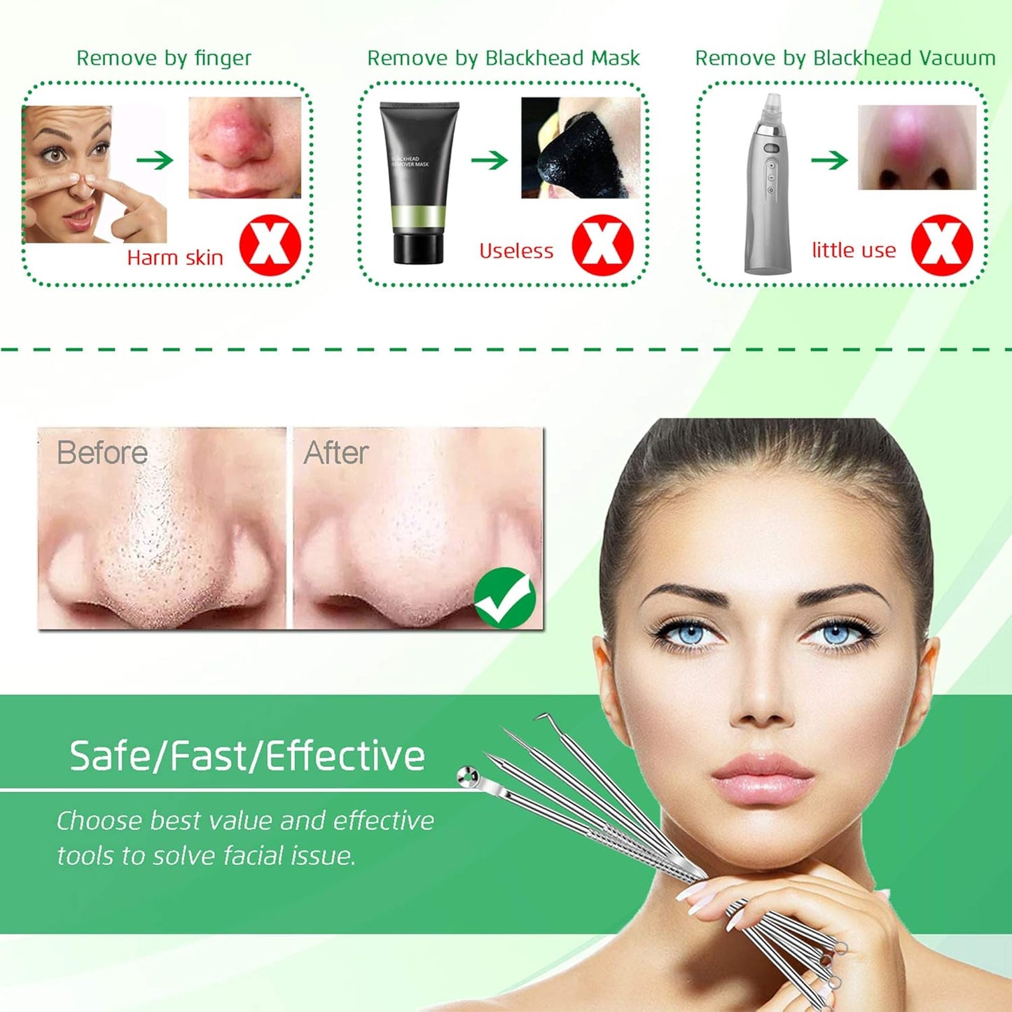 5PCS Blackhead Remover Comedone Extractor, Curved Blackhead Tweezers Kit, Professional Stainless Pimple Acne Blemish Removal Tools Kit for Manual
