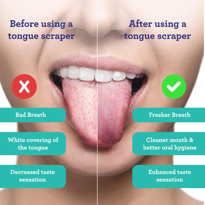 GuruNanda Tongue Scraper for Adults (2 Pack) with Travel Case, 420 Medical-Grade 100% Stainless Steel Tongue Cleaner, Aids in Fresh Breath & Oral Care